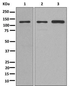 Western blot - Anti-KIRREL 3 antibody [EPR11631(2)] - BSA and Azide free (AB250077)