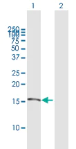 Western blot - Anti-Kisspeptin antibody (AB172012)