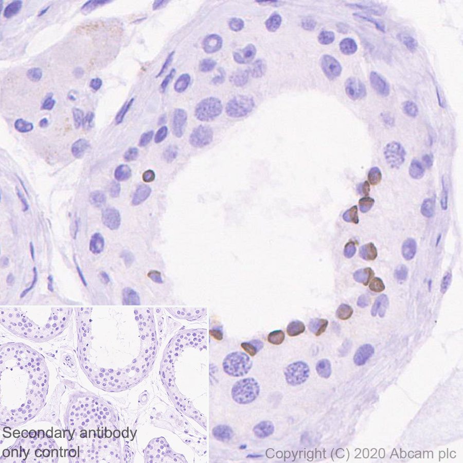 Immunohistochemistry (Formalin/PFA-fixed paraffin-embedded sections) - Anti-Kisspeptin antibody [EPR23770-189] (AB275874)
