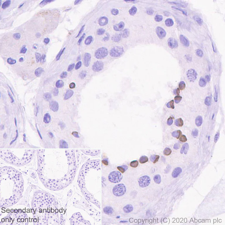 Immunohistochemistry (Formalin/PFA-fixed paraffin-embedded sections) - Anti-Kisspeptin antibody [EPR23770-189] (AB275874)