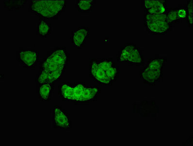 Immunocytochemistry/ Immunofluorescence - Anti-KIST/KIS antibody (AB237501), expandable thumbnail