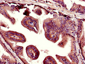 Immunohistochemistry (Formalin/PFA-fixed paraffin-embedded sections) - Anti-KIST/KIS antibody (AB237501), expandable thumbnail