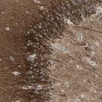 Immunohistochemistry (Formalin/PFA-fixed paraffin-embedded sections) - Anti-KK-LC-1 antibody (AB121219)