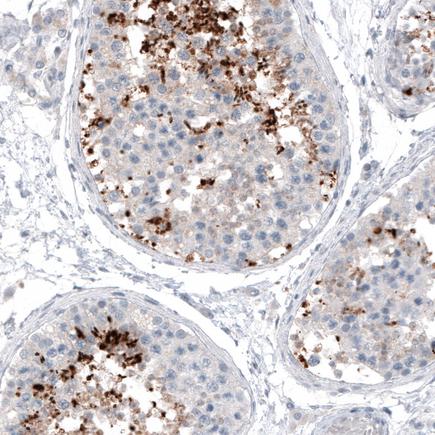 Immunohistochemistry (Formalin/PFA-fixed paraffin-embedded sections) - Anti-KK-LC-1 antibody [CL4762] (AB219971)