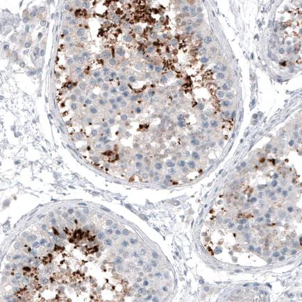 Immunohistochemistry (Formalin/PFA-fixed paraffin-embedded sections) - Anti-KK-LC-1 antibody [CL4762] (AB219971)