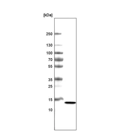 Western blot - Anti-KK-LC-1 antibody [CL4762] (AB219971)
