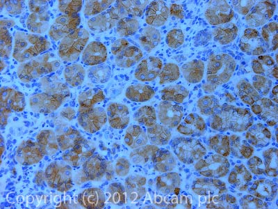 Immunohistochemistry (Formalin/PFA-fixed paraffin-embedded sections) - Anti-KLB antibody (AB106794), expandable thumbnail