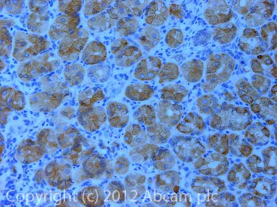 Immunohistochemistry (Formalin/PFA-fixed paraffin-embedded sections) - Anti-KLB antibody (AB106794)