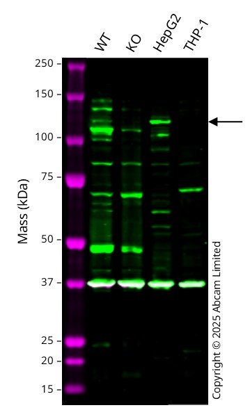 Western blot - Anti-KLB antibody (AB106794)