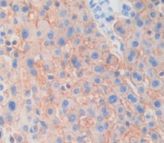 Immunohistochemistry (Formalin/PFA-fixed paraffin-embedded sections) - Anti-KLB antibody (AB233416)