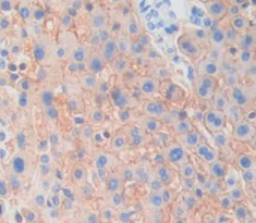Immunohistochemistry (Formalin/PFA-fixed paraffin-embedded sections) - Anti-KLB antibody (AB233416)