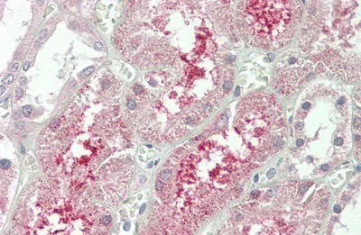 Immunohistochemistry (Formalin/PFA-fixed paraffin-embedded sections) - Anti-KLB antibody (AB233416)