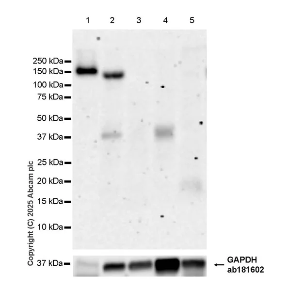 Western blot - Anti-KLB antibody [EPR28904-537] - BSA and Azide free (AB326600)