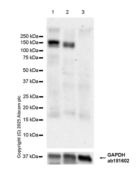 Western blot - Anti-KLB antibody [EPR28904-537] - BSA and Azide free (AB326600)