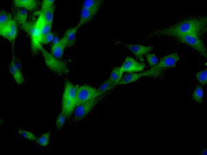 Immunocytochemistry/ Immunofluorescence - Anti-KLC1 antibody [EPR12441(B)] (ab174273), expandable thumbnail