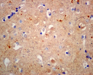 Immunohistochemistry (Formalin/PFA-fixed paraffin-embedded sections) - Anti-KLC1 antibody [EPR12441(B)] (AB174273), expandable thumbnail