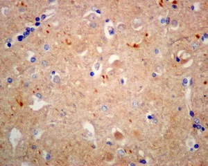 Immunohistochemistry (Formalin/PFA-fixed paraffin-embedded sections) - Anti-KLC1 antibody [EPR12441(B)] (AB174273)