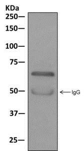 Immunoprecipitation - Anti-KLC1 antibody [EPR12441(B)] (AB174273), expandable thumbnail