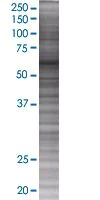SDS-PAGE - KLC1 overexpression 293T lysate (whole cell) (AB94276)