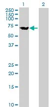 Western blot - KLC1 overexpression 293T lysate (whole cell) (AB94276)