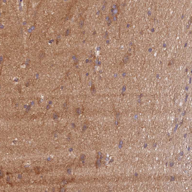Immunohistochemistry (Formalin/PFA-fixed paraffin-embedded sections) - Anti-KLC2 antibody (AB254848)