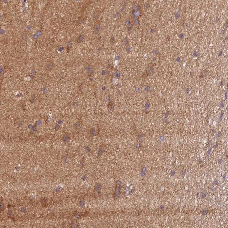 Immunohistochemistry (Formalin/PFA-fixed paraffin-embedded sections) - Anti-KLC2 antibody (AB254848)