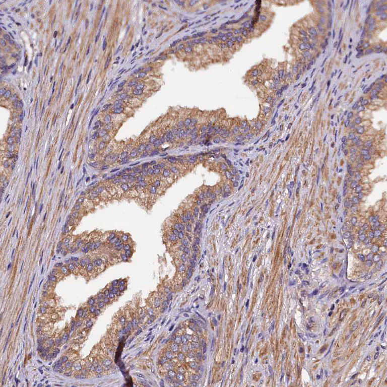 Immunohistochemistry (Formalin/PFA-fixed paraffin-embedded sections) - Anti-KLC2 antibody (AB254848)