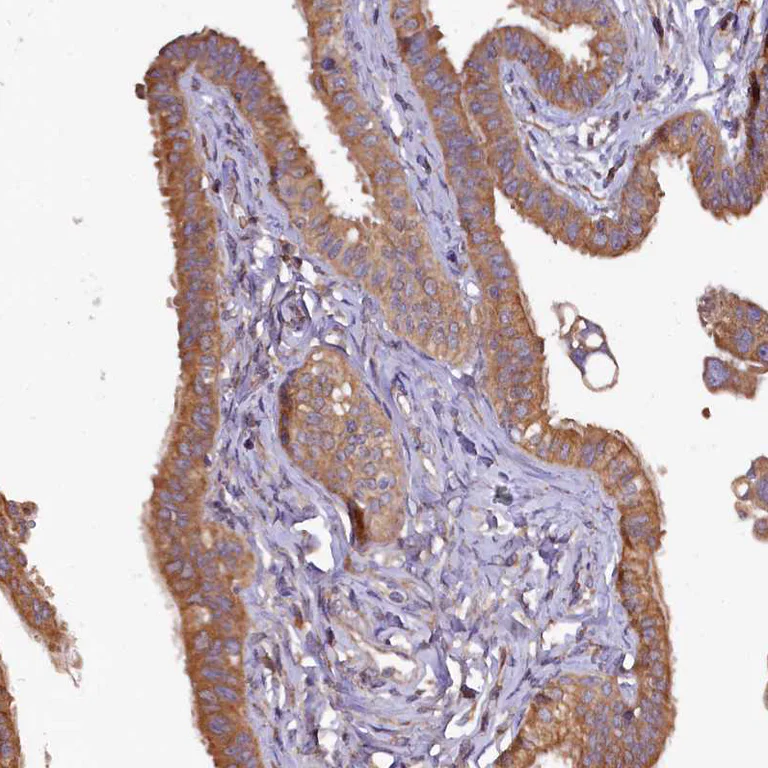 Immunohistochemistry (Formalin/PFA-fixed paraffin-embedded sections) - Anti-KLC2 antibody (AB254848)