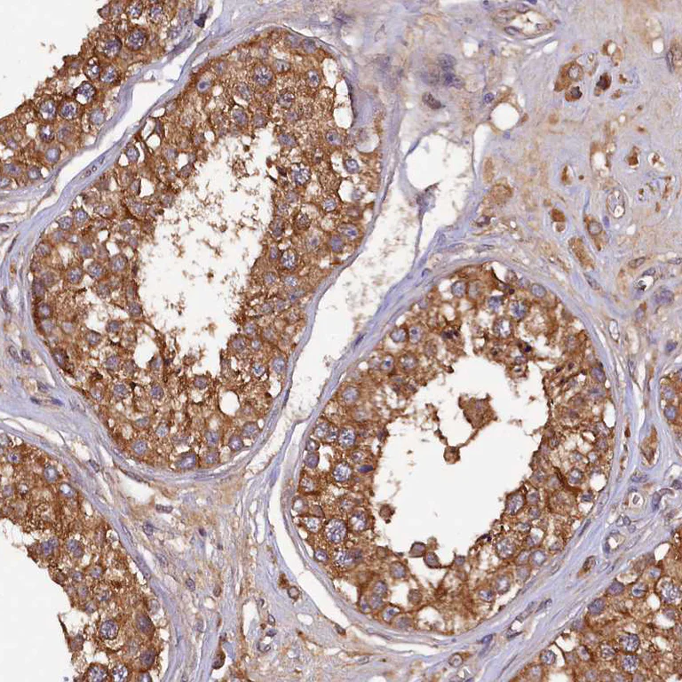Immunohistochemistry (Formalin/PFA-fixed paraffin-embedded sections) - Anti-KLC2 antibody (AB254848)