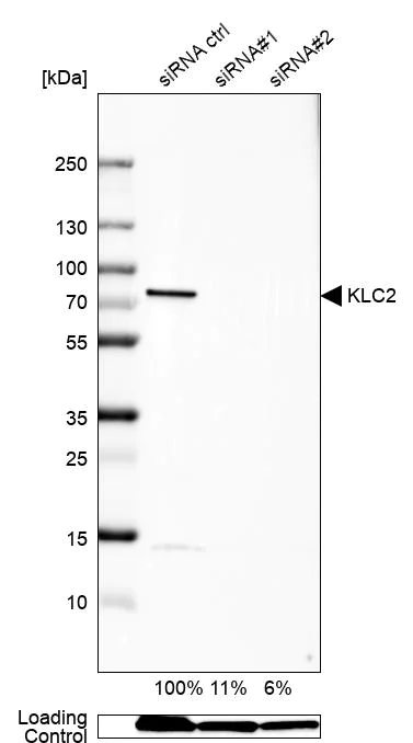 Western blot - Anti-KLC2 antibody (AB254848)