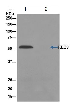 Immunoprecipitation - Anti-KLC3 antibody [EPR11149(2)] - BSA and Azide free (AB250220), expandable thumbnail