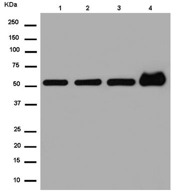 Western blot - Anti-KLC3 antibody [EPR11149(2)] - BSA and Azide free (AB250220), expandable thumbnail