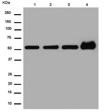 Western blot - Anti-KLC3 antibody [EPR11149(2)] - BSA and Azide free (AB250220)