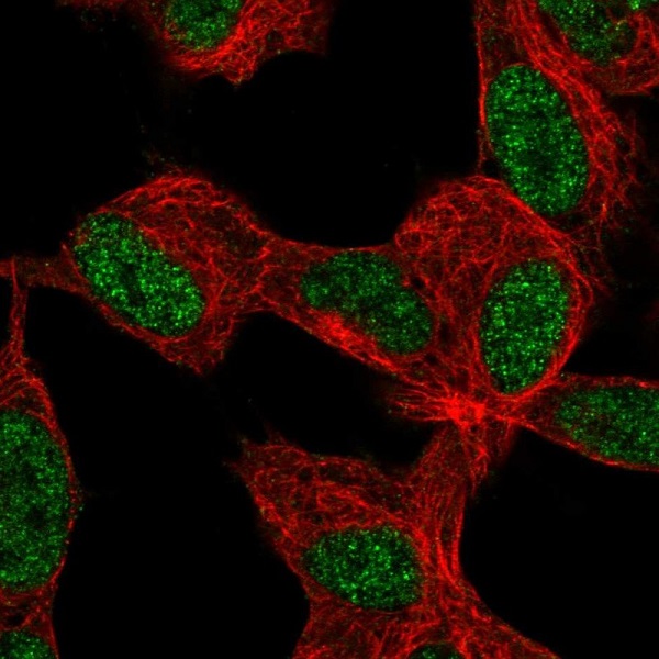 Immunocytochemistry/ Immunofluorescence - Anti-KLF12 antibody (AB221602)