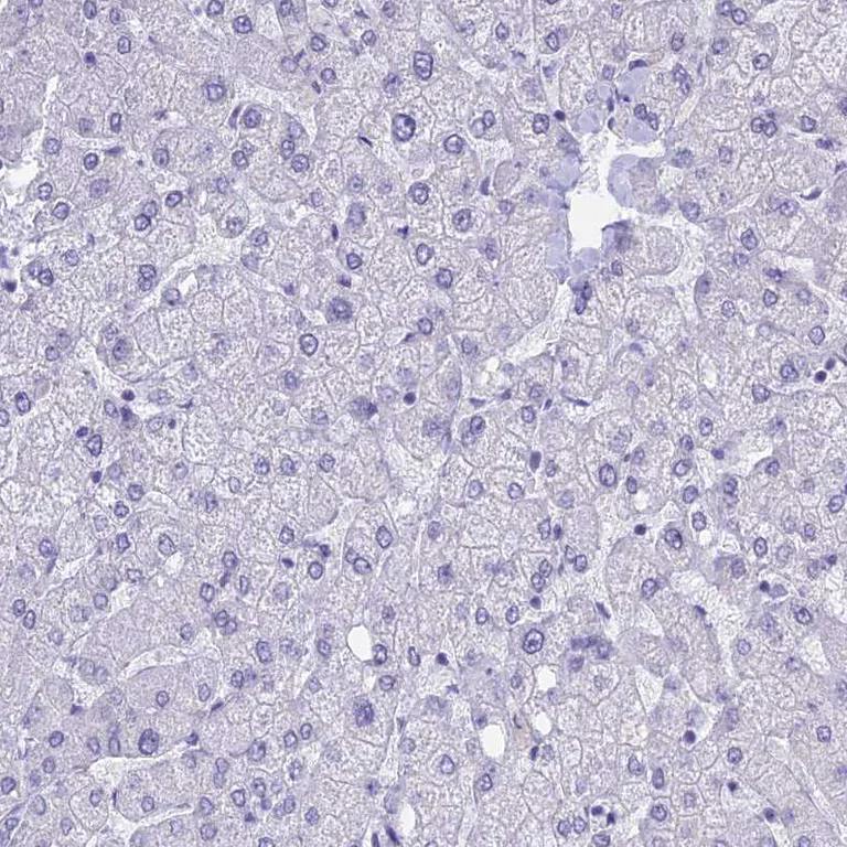Immunohistochemistry (Formalin/PFA-fixed paraffin-embedded sections) - Anti-KLF14 antibody (AB244475)