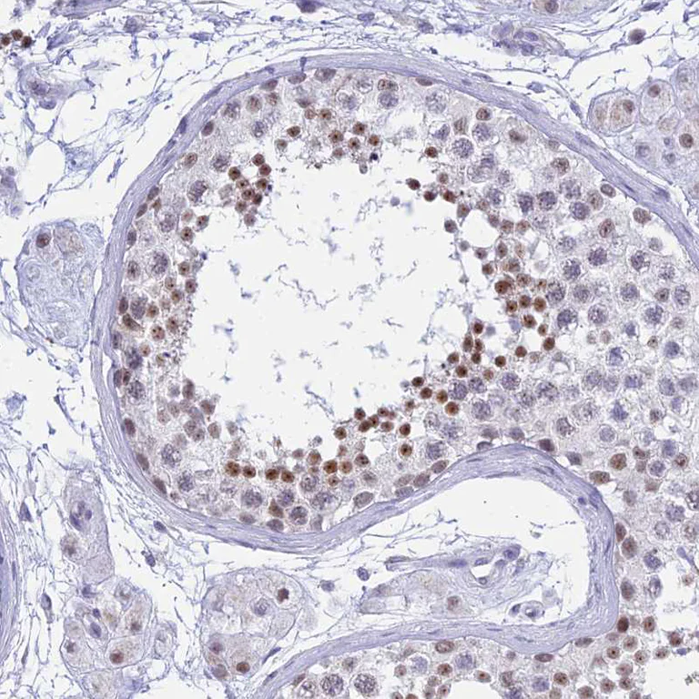 Immunohistochemistry (Formalin/PFA-fixed paraffin-embedded sections) - Anti-KLF14 antibody (AB244475)