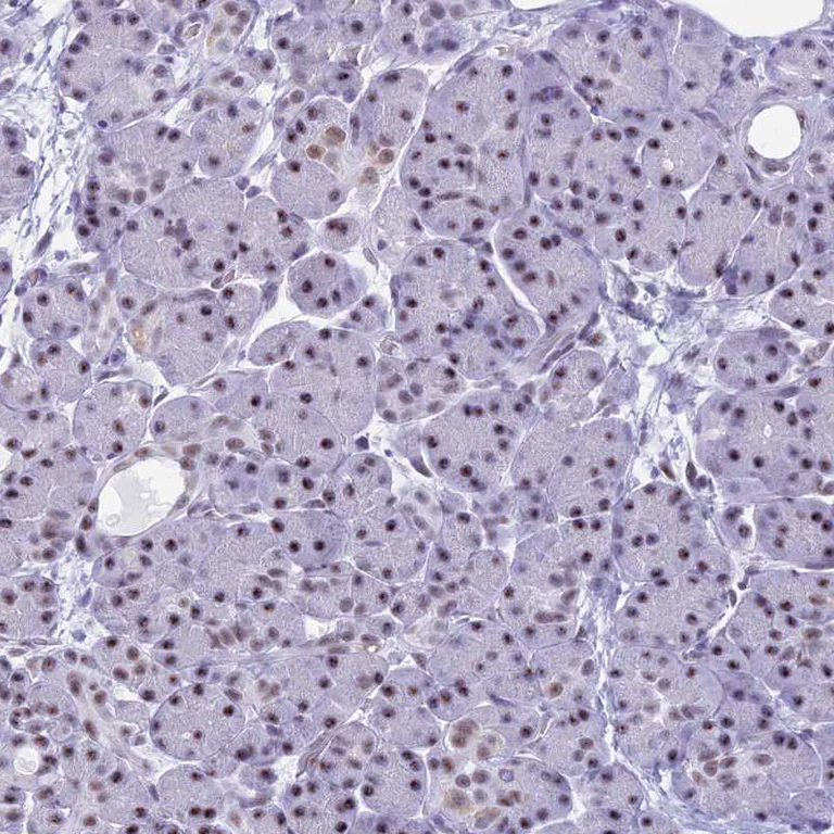 Immunohistochemistry (Formalin/PFA-fixed paraffin-embedded sections) - Anti-KLF14 antibody (AB244475)