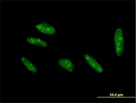 Immunocytochemistry/ Immunofluorescence - Anti-KLF15 antibody (AB167192), expandable thumbnail