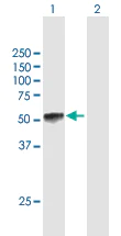 Western blot - Anti-KLF15 antibody (AB167192)
