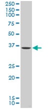 Western blot - Anti-KLF2 antibody (AB194486)