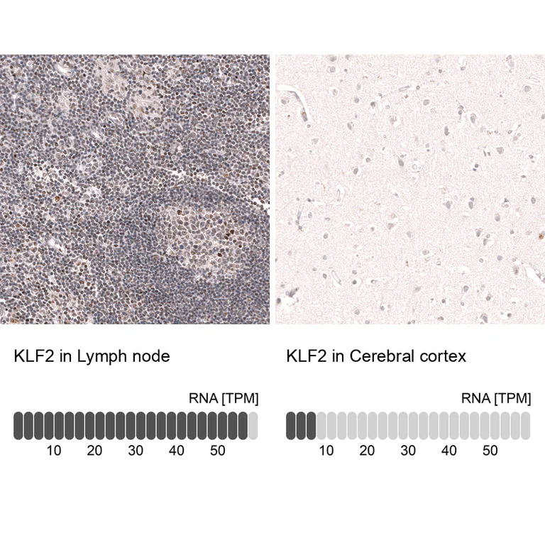 Immunohistochemistry (Formalin/PFA-fixed paraffin-embedded sections) - Anti-KLF2 Antibody [CL14502] (AB327155)
