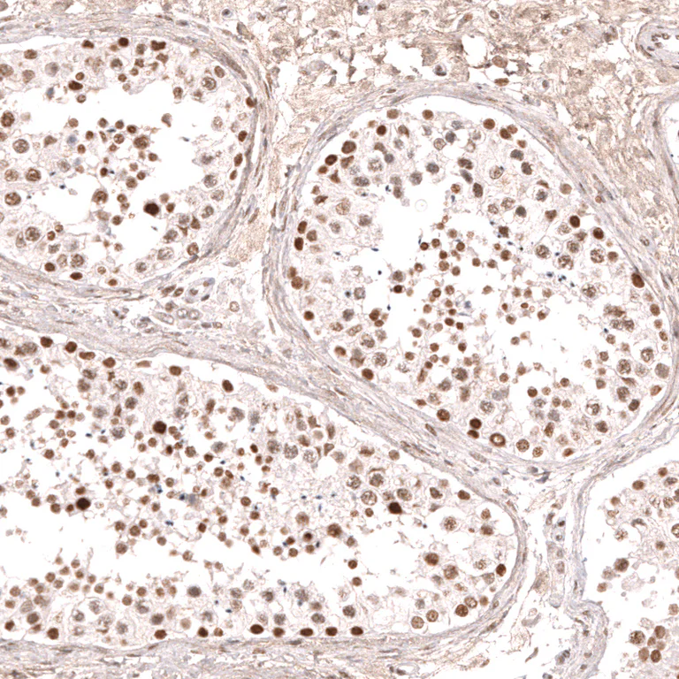 Immunohistochemistry (Formalin/PFA-fixed paraffin-embedded sections) - Anti-KLF2 Antibody [CL14502] (AB327155)