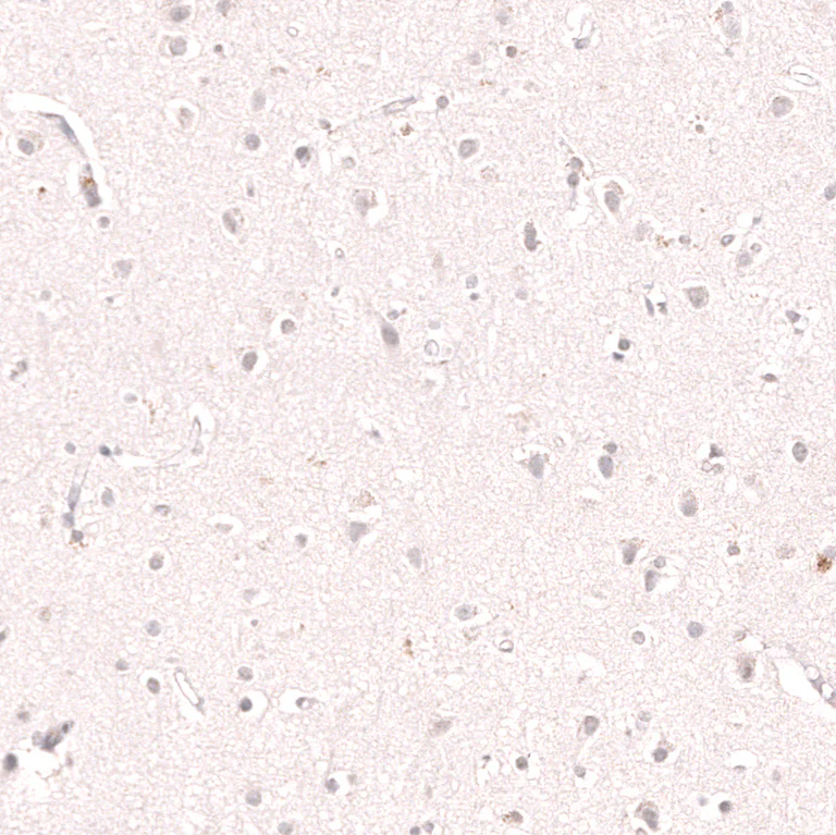 Immunohistochemistry (Formalin/PFA-fixed paraffin-embedded sections) - Anti-KLF2 Antibody [CL14502] (AB327155)