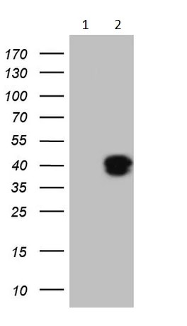 Western blot - Anti-KLF2 antibody [OTI5F1] (AB236507)