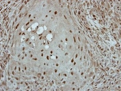 Immunohistochemistry (Formalin/PFA-fixed paraffin-embedded sections) - Anti-KLF3 antibody (AB154531)