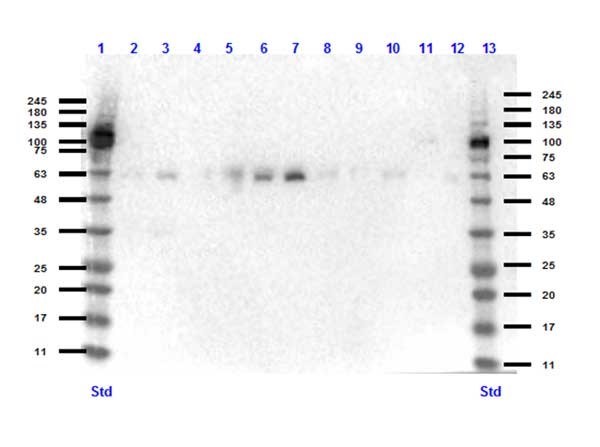 Western blot - Anti-KLF4 antibody (AB216875), expandable thumbnail