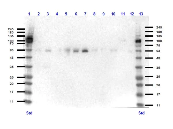Western blot - Anti-KLF4 antibody (AB216875)