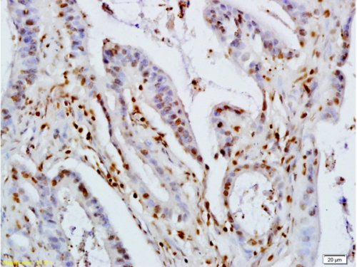 Immunohistochemistry (Formalin/PFA-fixed paraffin-embedded sections) - Anti-KLF4 antibody (AB216968), expandable thumbnail