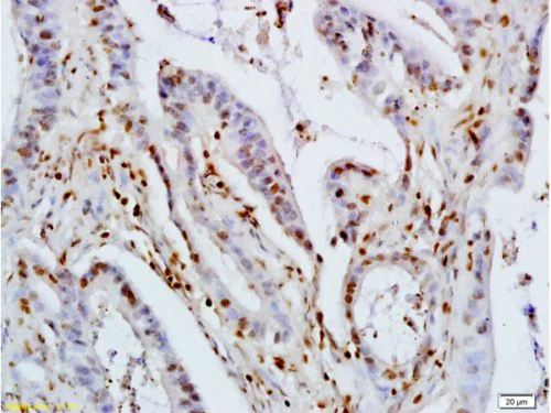 Immunohistochemistry (Formalin/PFA-fixed paraffin-embedded sections) - Anti-KLF4 antibody (AB216968)