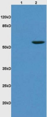 Western blot - Anti-KLF4 antibody (AB216968), expandable thumbnail